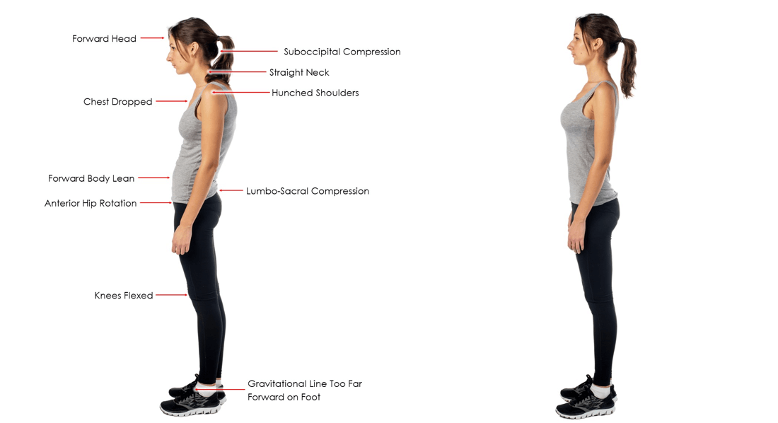 Bad vs Good Posture 1 e1758529871645