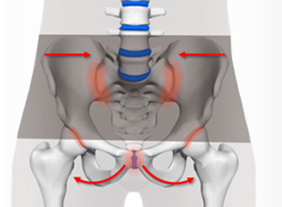 Modèle de squelette montrant une large ceinture sacro-iliaque aggravant les ligaments autour de l'articulation SI inférieure